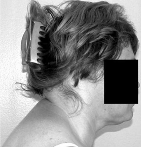 Patient Image