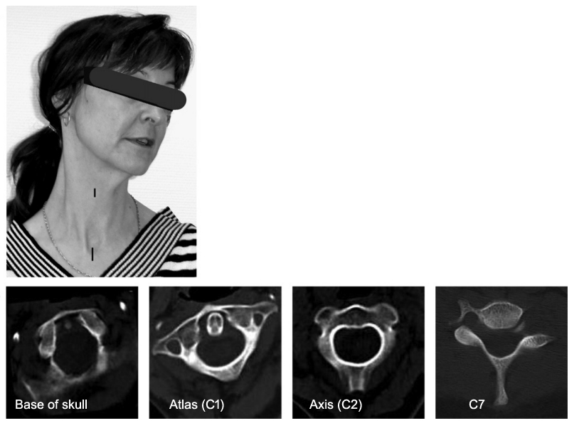 Patient Image