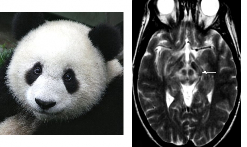 Face of the Giant Panda sign
