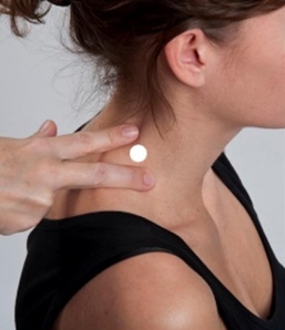 Surface Anatomy: Injection Sites for Levator Scapulae muscle