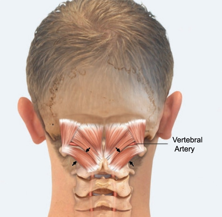 Anatomy: Insertion and Origin of OCI (Indicated by the arrowheads)