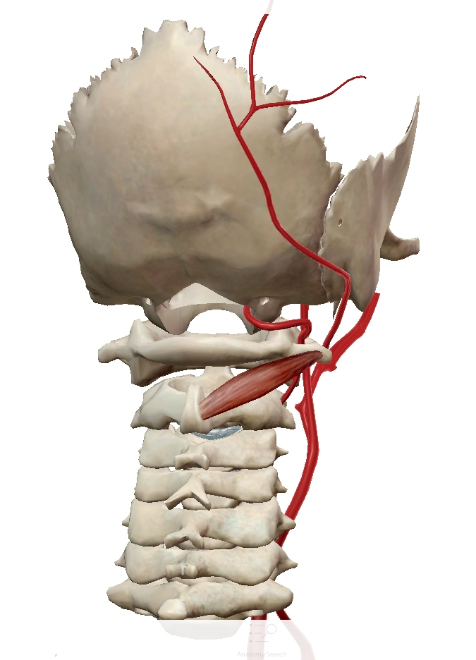 OCI and vertebral artery