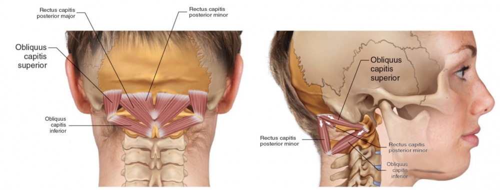 Anatomy: insertion and origin of rectus capitis major