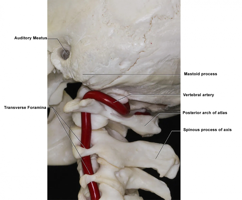 Lateral view of the termination of the vertebral artery