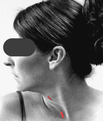 Patient Image