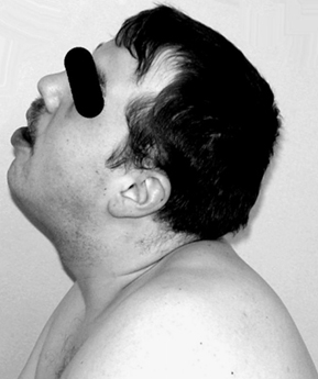 Patient Image