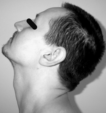 Patient Image